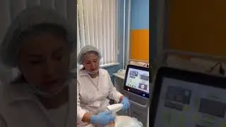 СМАС лифтинг - безоперационная подтяжка лица