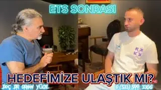 AŞIRI EL TERLEMESİ AMELİYATININ SONUÇLARI