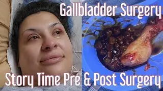 Gallbladder Surgery 101 | My Experience That Led to Removal of My Gallbladder