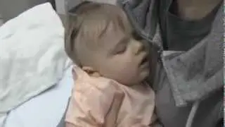 Pediatric Intussusception Emergency (Bowel Obstruction)