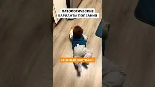 ПАТОЛОГИЧЕСКИЕ ВАРИАНТЫ ПОЛЗАНИЯ 