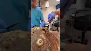 Gross or Oddly Satisfying?
