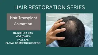 Dr. Shreya Das - Hair Transplant Surgeon in Kolkata, West Bengal| Painless FUE hair transplant