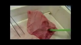 Observations de poumons en 5ème - SVT
