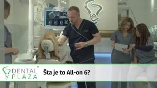Šta je to all-on six?