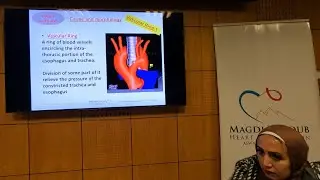 Aortic Arch Anomalies (En) - Soha Romeih