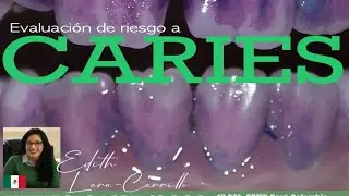 CONVERSATORIO 32 | Evaluación de riesgo a caries | Edith Lara-Carrillo