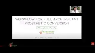 Workflow for Full Arch Implant Prosthetic Conversion by Dr Armand Bedrossian