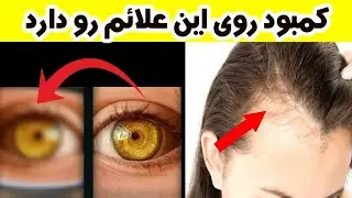تار میبنید؟ ضعیفی چشم دارید؟ موه های نازک و ریزش مو دارید؟ پس اینو ببینید.