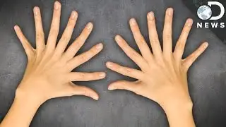 Why Do We Have 10 Fingers and 10 Toes?