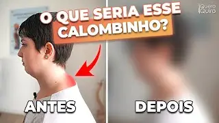 SE VOCÊ TEM ESSE CALOMBINHO, VOCÊ PRECISA SABER DISSO