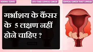Cervical Cancer यह 5 लक्षण नहीं होने चाहिए - Symptoms of Cervical Cancer