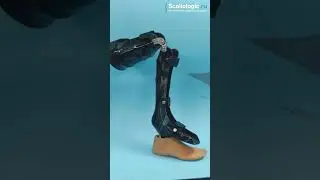 Укорочение ноги. Как исправить