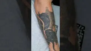 Лазерное удаление тату