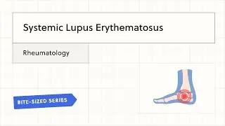 Systemic Lupus Erythematosus