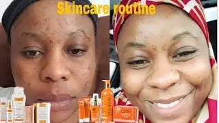 My Skincare routine for Acne/Problematic skin|MAKARI DE SUISSE|