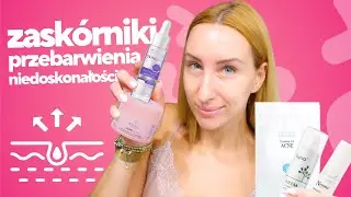 Najlepsze kosmetyki na zaskórniki, przebarwienia oraz niedoskonałości