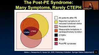 Chronic Thromboembolic PH- Alice Goyanes, MD