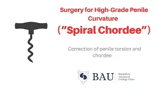 High grade penile curvature / Penile torsion with chordee (“Spiral Chordee”)