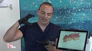 Gülüş Tasarımı Uygulaması Nedir, Nasıl Yapılır?