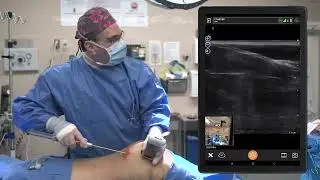 Enxertia em Cirurgia Plástica - Clarius/Mobissom
