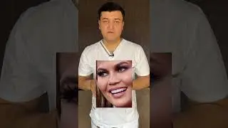 Винир