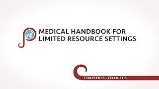 Cellulitis - Chapter 16 of Medical Handbook for Limited Resource Settings