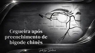 Cegueira após preenchimento de bigode chinês