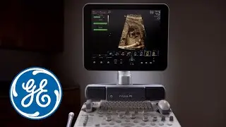 Voluson Performance 2016 L&D video | GE Healthcare