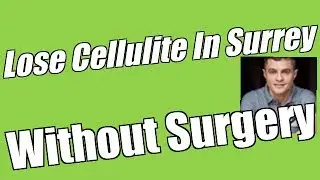 How To Lose Cellulite In Surrey