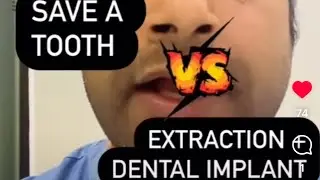 Should You Save a Tooth or Opt for a Dental Implant? | Evidence-Based Dentistry Insights