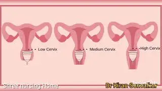 #menstrualcup #menstrualhygieneday #periodcup #womenempowerment #plasticpollution #menstrualcycle