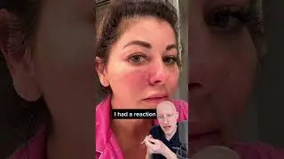 SHOCKING Allergic Reaction To Filler | Doctor Reacts