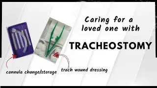 FAQ Tracheostomy | Based on experience with my mother