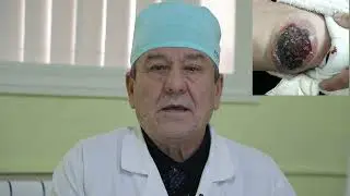 НОР, ГЕМОНГИОМА