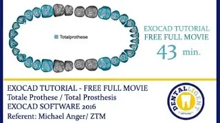 EXOCAD TUTORIAL - FREE FULL MOVIE -  Totale Prothese / Total Prosthesis - EXOCAD SOFTWARE 2016