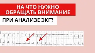 What should NOT be ignored when analyzing an ECG? What should you pay attention to when analyzing...
