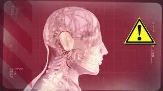 мальформация мастер 7