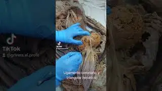 Ligamento coronario y triangular del hígado