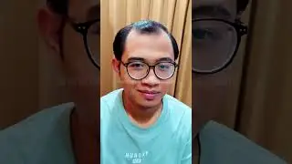 Sebelum dan Sesudah menggunakan toupee bagian depan