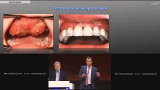Dr. Dennis Rohner: Master the challenges in reconstructive surgery | Nobel Biocare