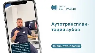 🦷 Аутотрансплантация зубов