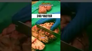 Тайна мозга Альберта Эйнштейна