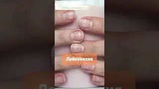 Как печень подаёт сигналы через кожу, ногти и волосы