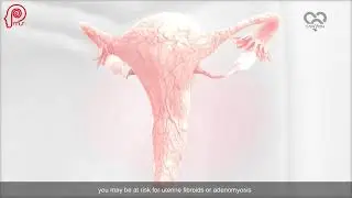 Uterine fibroids & adenomyosis treatment