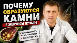 Причины камней в желчном пузыре