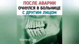 ПОСЛЕ АВАРИИ ОЧНУЛСЯ В БОЛЬНИЦЕ С ДРУГИМ ЛИЦОМ
