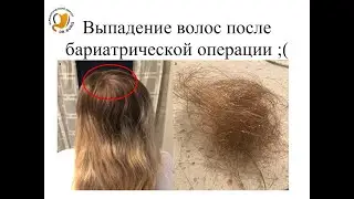 Выпадение волос после бариатрической операции;(