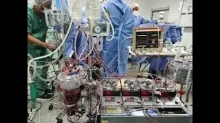 CUIDADOS DE ENFERMAGEM AOS PACIENTES NO PÓS OPERATÓRIO DE CIRURGIA CARDÍACA