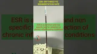 Erythrocyte Sedimentation Rate Physiology Practical ll Types ll Normal Range